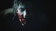 RESIDENT EVIL 2 / BIOHAZARD RE:2 (Xbox Series X/S, Windows 10) - Xbox Live Key - UNITED KINGDOM