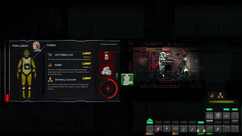 Barotrauma